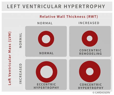 normal lv mass|left ventricular myocardial mass.